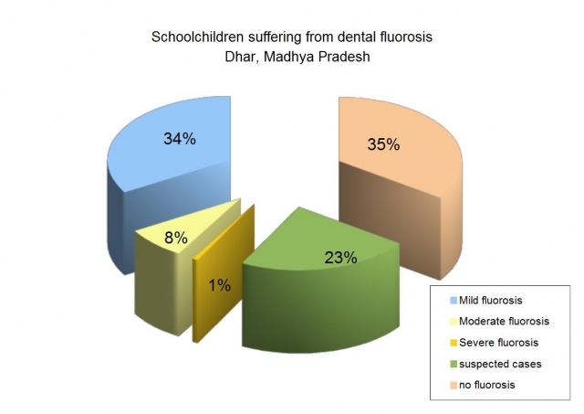 School children suffering from dental fluorosis, Dhar, Madhya Pradesh