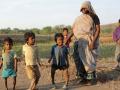 Several young children in Jhabua suffer from skeletal fluorosis (Source: INREM Foundation)