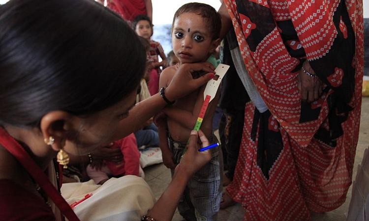 Measuring for malnutrition in Madhya Pradesh (Source: Russell Watkins, Wikimedia Commons)