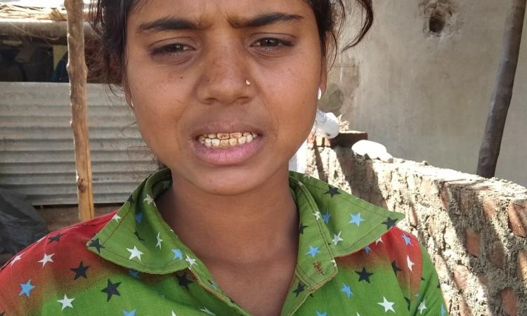 Village woman shows her fluorosis-affected teeth. (Pic courtesy: PSI)